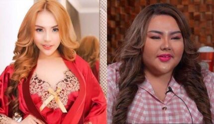 Lisa Mariana Bangkit: Endorse Potong Lambung Setelah Dihina?