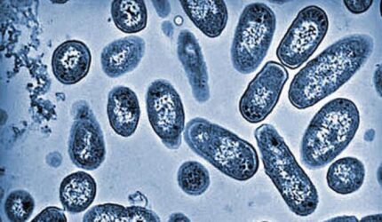 Waspada Keracunan Massal Bogor: Kenali Bakteri E. Coli dan Salmonella!