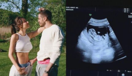 Pete Davidson Hamilkan Elsie Hewitt! 4 Bulan Pacaran Langsung Anak?
