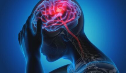 Stroke: Cegah Cacat Permanen dengan Tindakan Cepat & Tepat!